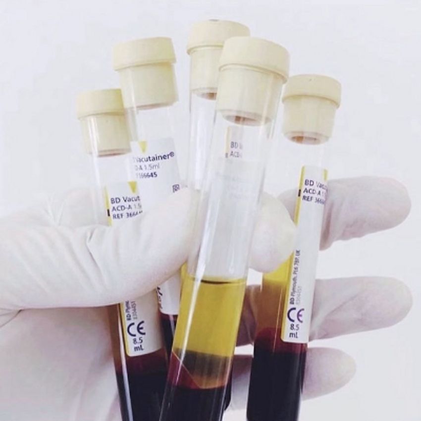 برند: بی دی آمریکایی
تعداد و فواصل جلسات: با توجه به معاینه