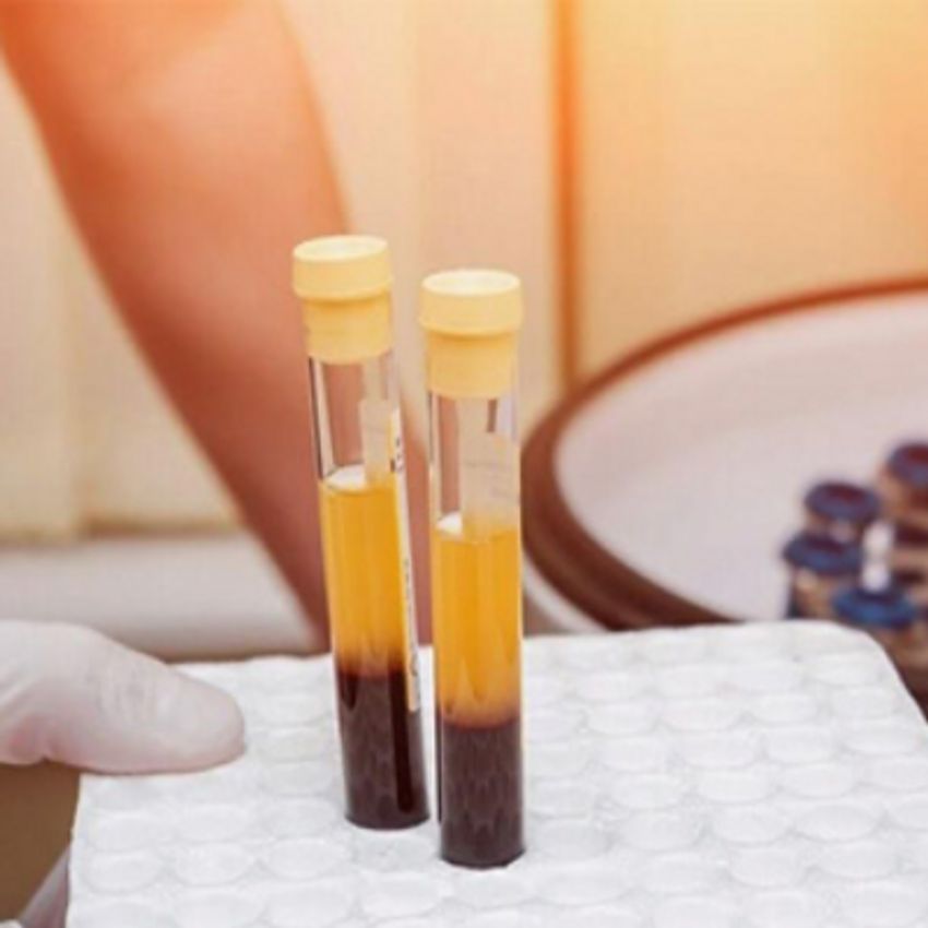 برند: بی دی آمریکایی
تعداد و فواصل جلسات: با توجه به معاینه