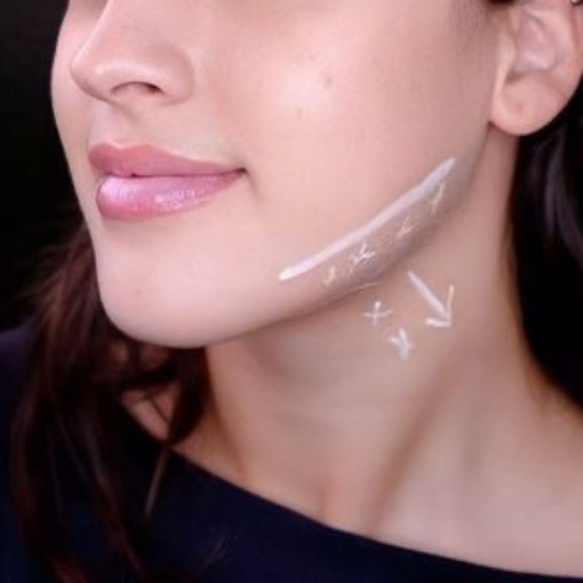 برند مصپورت - کاربرد: لیفت نسبی یک سوم میانی و تحتانی صورت