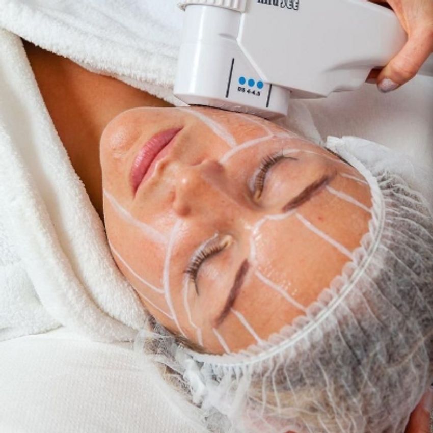 دستگاه هایفو اولترا سه بعدی