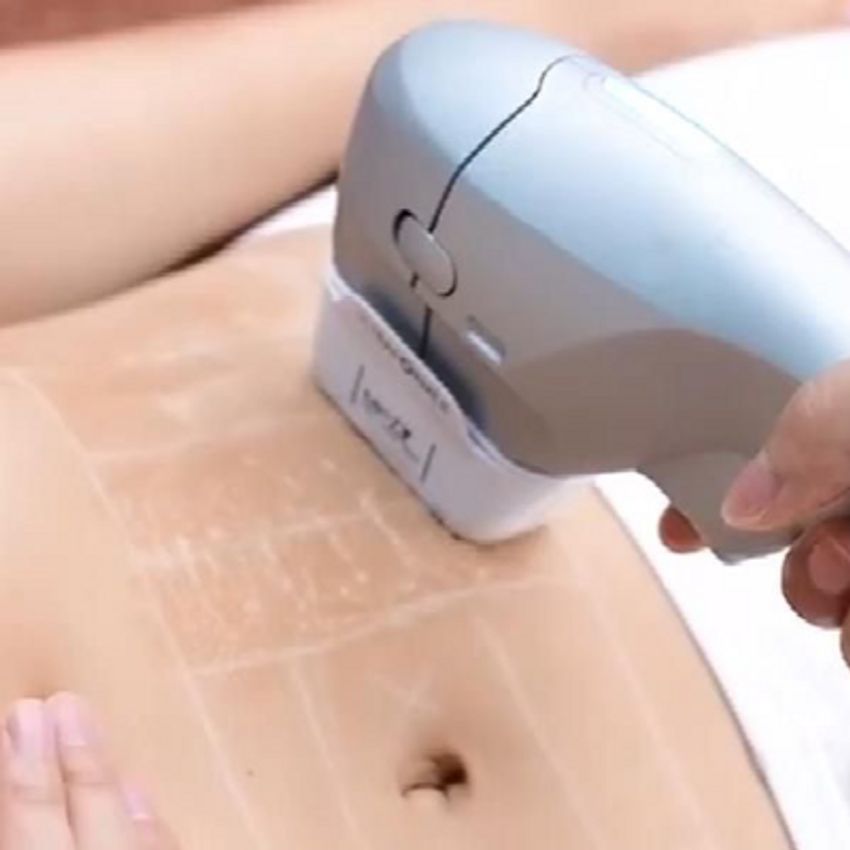 دستگاه هایفو اولترا سه بعدی
هزینه بابت هر یک ناحیه است