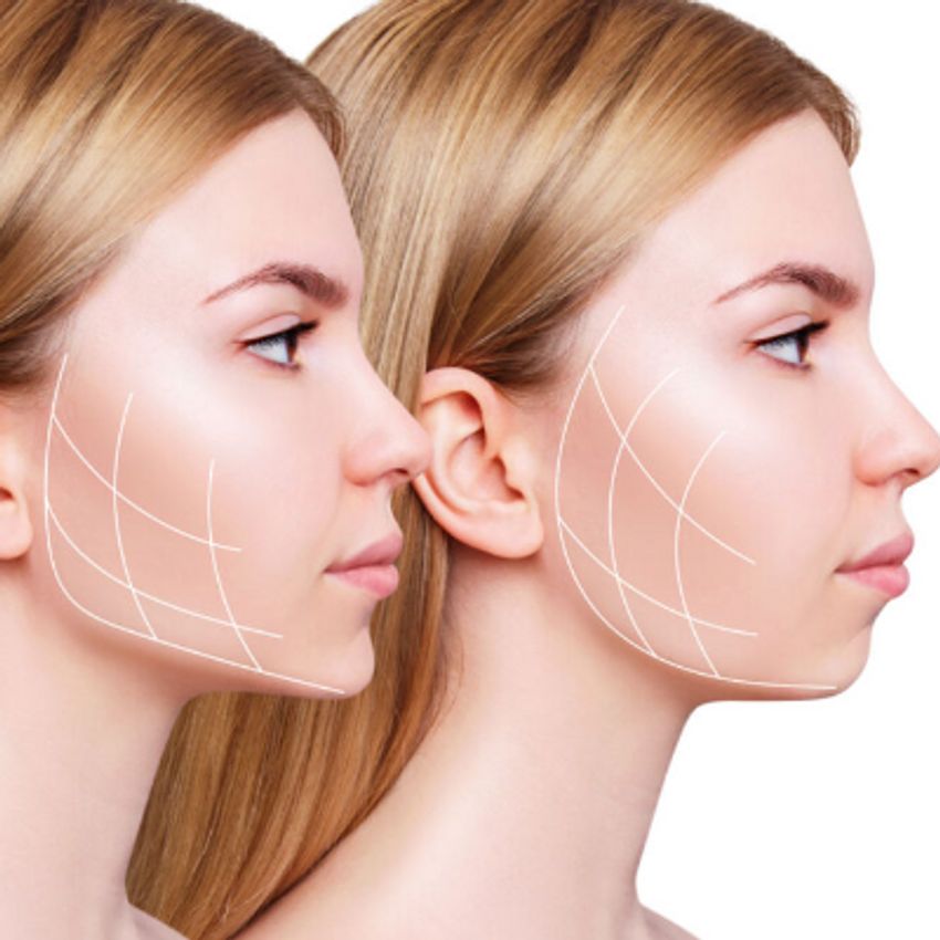 بوکال + ساکشن غبغب