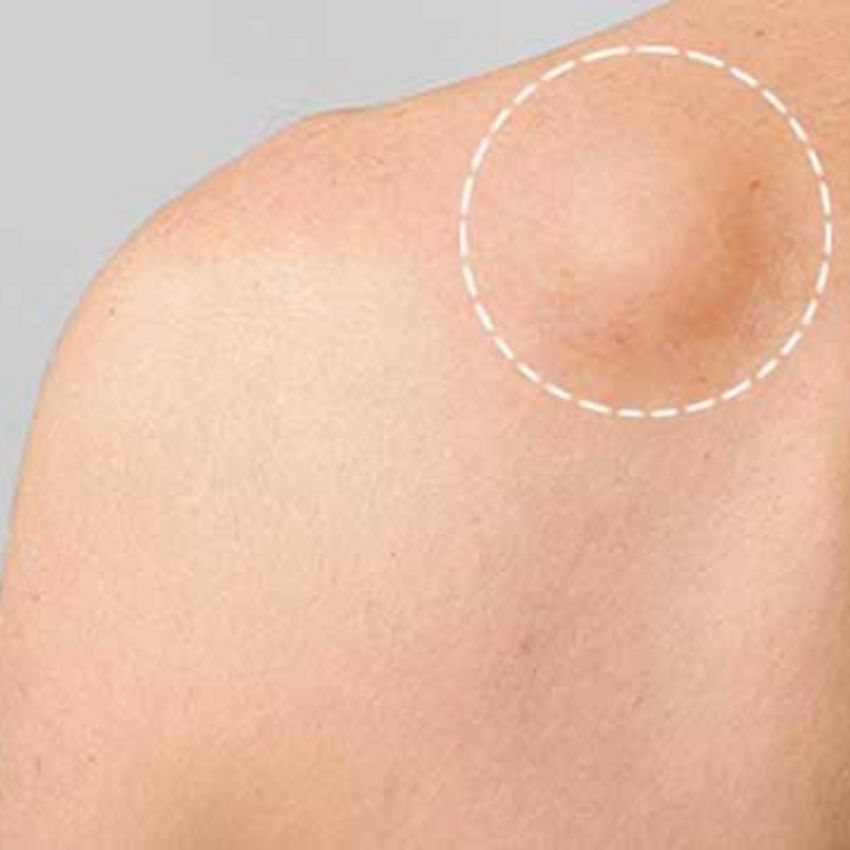 شروع از 1 م با توجه به سایز و محل