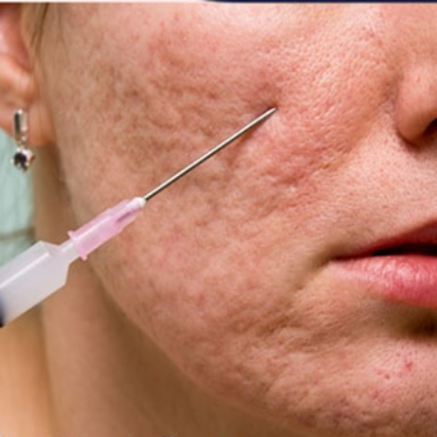 با توجه به محل و وسعت افزایش هزینه دارد